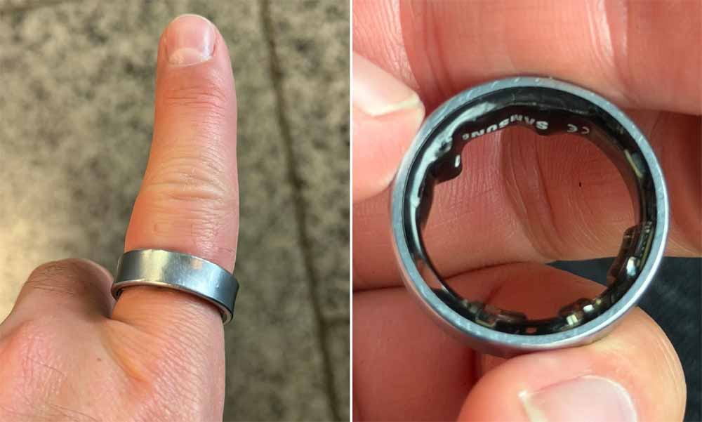 स्मार्ट रिंग के कारण फ्लाइट मिस, सीधे अस्पताल पहुँचा शख्स