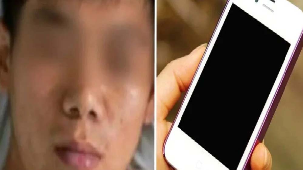 एक आईफोन की कीमत ज़िंदगी पर भारी, 17 साल का लड़का अब डायलिसिस का मोहताज