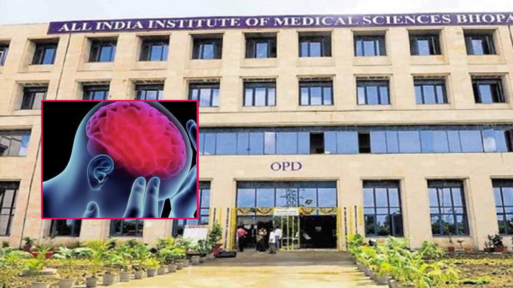 AIIMS भोपाल में स्ट्रोक मरीजों के लिए राहत, अब 24 घंटे में थक्का निकालने की सुविधा