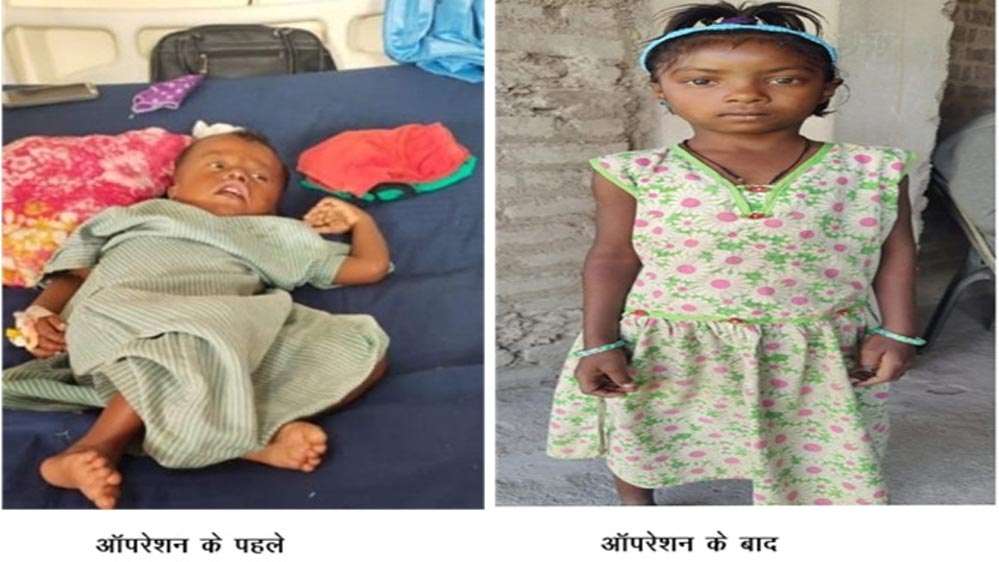 चिरायु योजना से बच्चों के चेहरे पर लौटी मुस्कान, माता-पिता ने मुख्यमंत्री विष्णुदेव साय का किया आभार व्यक्त