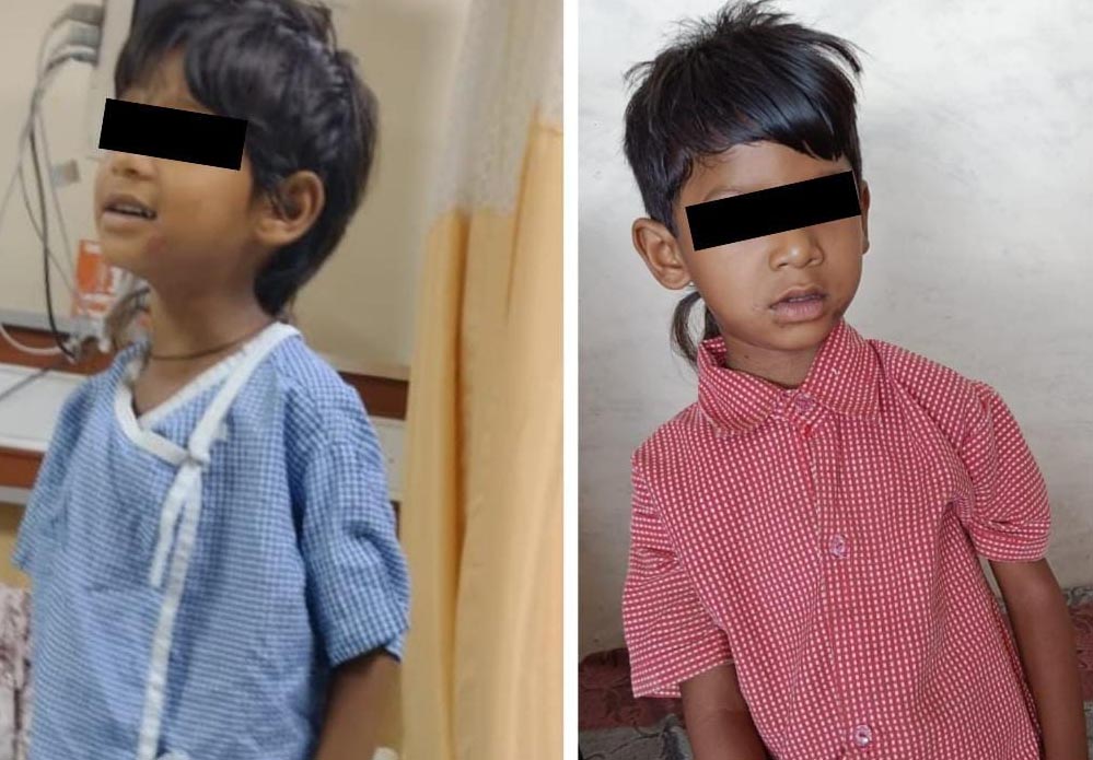 रायपुर: चिरायु योजना ने नित्या राजवाड़े को दिया नया जीवन, अस्पताल से मिली राहत