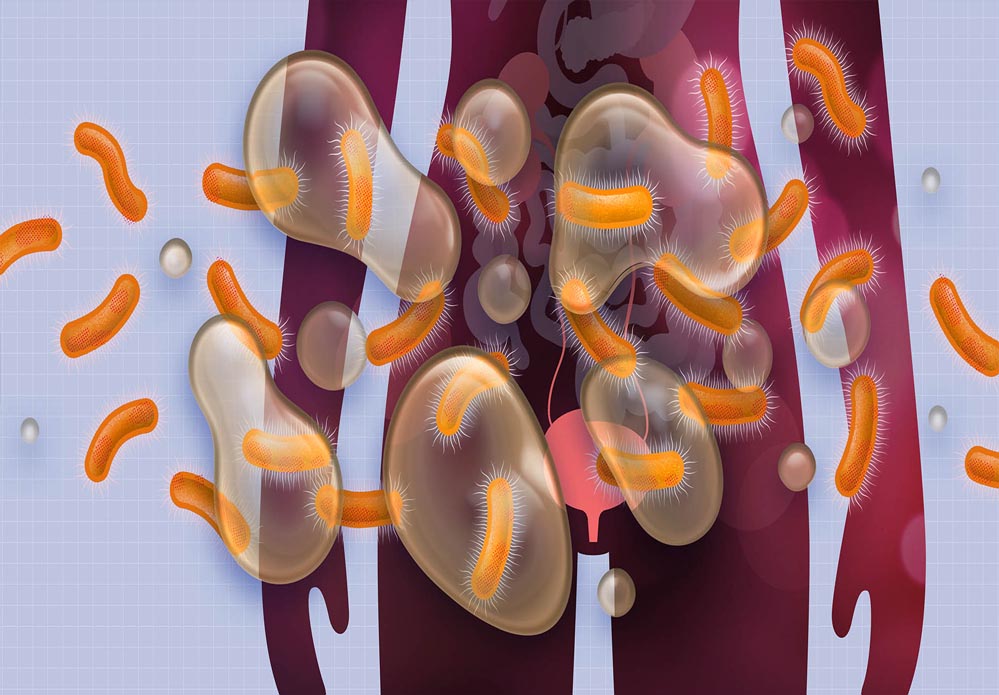 कम महिलाओं को पता है पेशाब की नली के इंफेक्शन की असल वजह, जलन का अनुभव नहीं सहन होता
