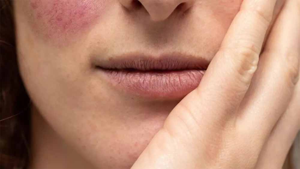 ठंड में स्किन हो रही है ड्राय? इन घरेलू टिप्स से मिलेगा नैचुरल मॉइश्चर और निखार