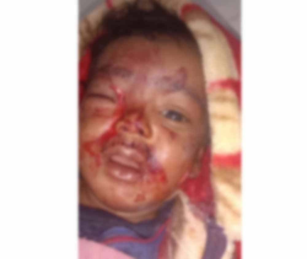 आंगन में खेल रहे 6 माह के मासूम को आवारा कुत्ते ने काटा, जिला अस्पताल में भर्ती