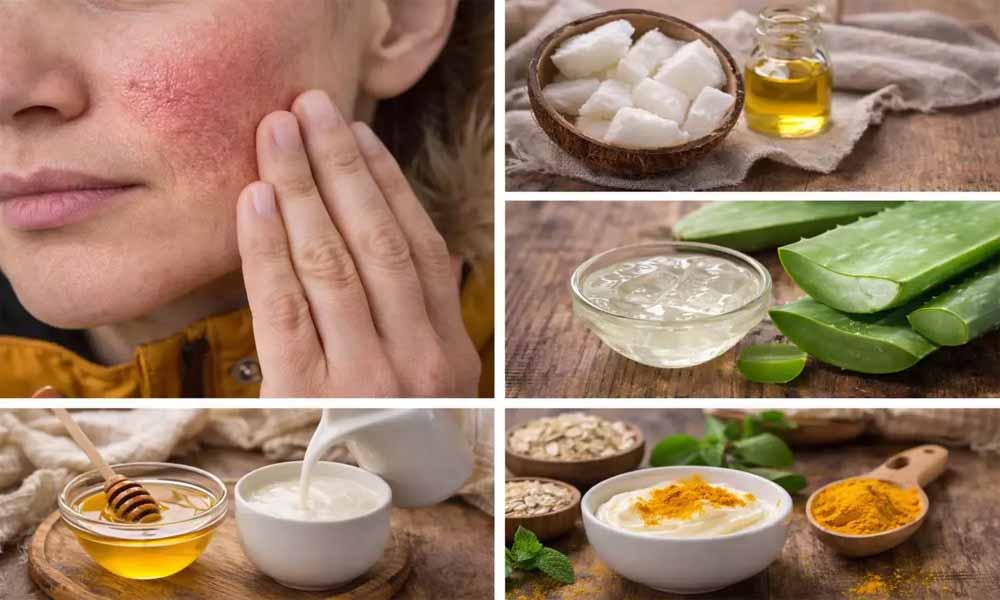 ठंड में चेहरे की नमी बरकरार रखने का घरेलू नुस्खा: दही से बने 5 असरदार फेस पैक