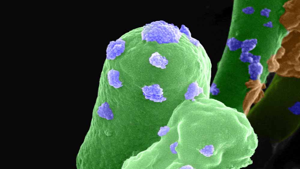 भारतीय शोधकर्ताओं की खोज: बैक्टीरिया की मदद से मंगल की मिट्टी से बनेगी मजबूत ईंट, अंतरिक्ष मिशनों में मदद