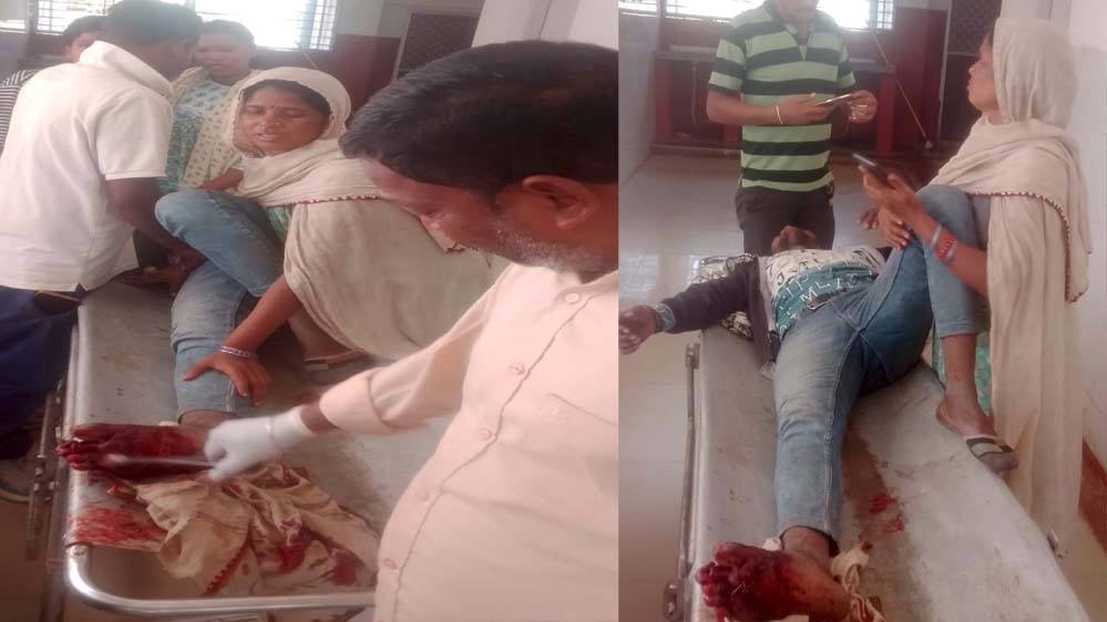 ऑटो-बाइक हादसे में बाइक चालक घायल, पैर की दो उंगलियों के टूटने का खतरा