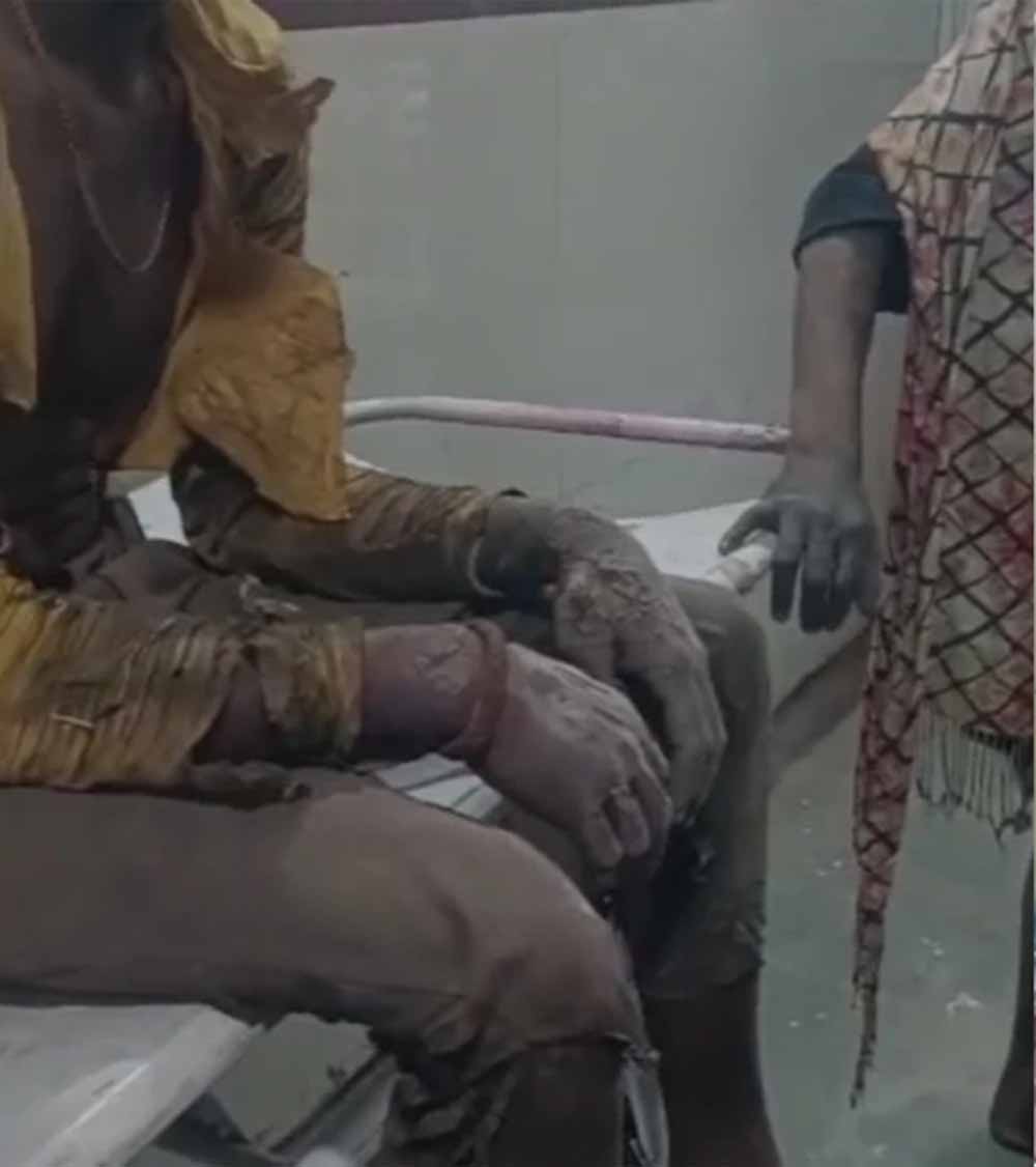 रंजिश ने लिया हिंसक रूप: कटनी में बमबाजी से 9 घायल, क्षेत्र में पुलिस का कड़ा पहरा