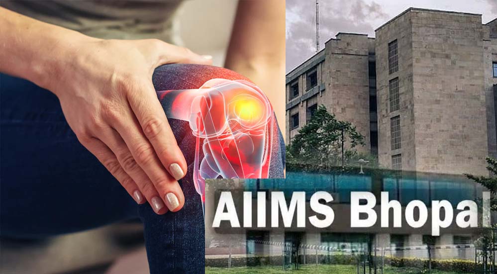 घुटनों के दर्द से स्थायी राहत, एम्स भोपाल और ग्वालियर आयुर्वेद संस्थान मिलकर करेंगे अचूक इलाज की खोज