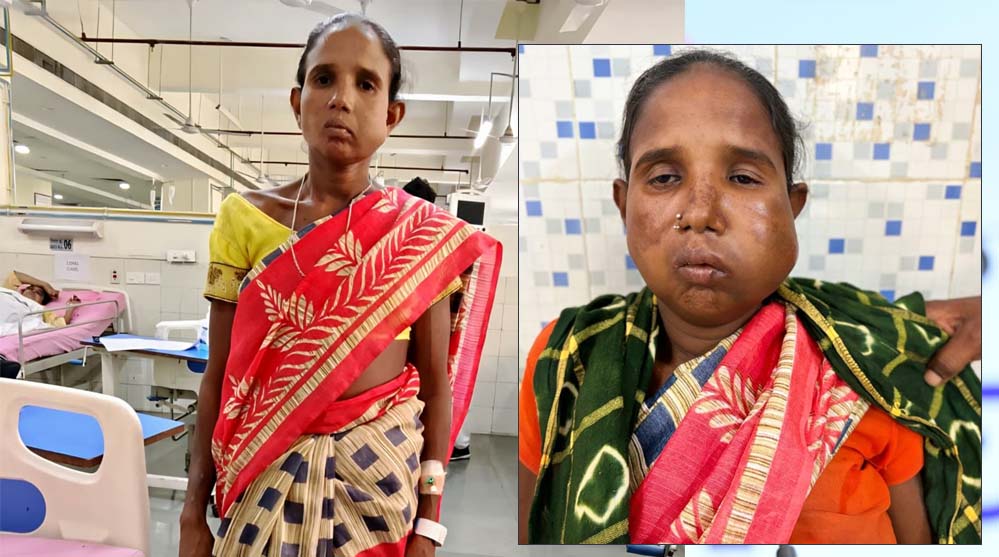 रायपुर में मेगा सुपर स्पेशलिटी हेल्थ कैंप से मिला नया जीवन, आयुष्मान कार्ड से हुआ बुधरी मड़कम का इलाज