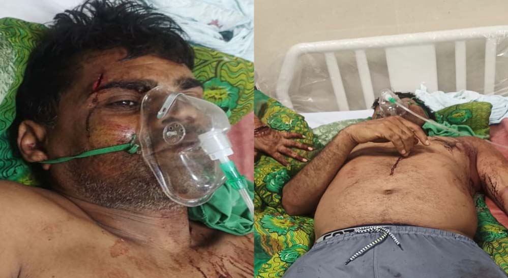 कुल्हाड़ी से हमला: गाली-गलौज का विरोध करने पर पूर्व जनपद सदस्य प्रतिनिधि पर जानलेवा वार