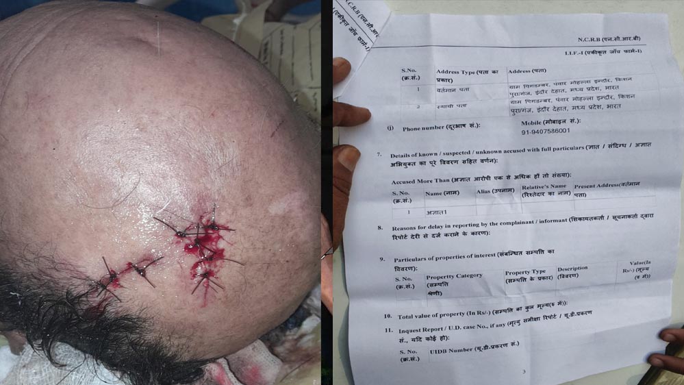 अधिमान्य पत्रकार नेतृत्व समिति के प्रदेश कार्यवाहक अध्यक्ष पर प्राण घातक हमला