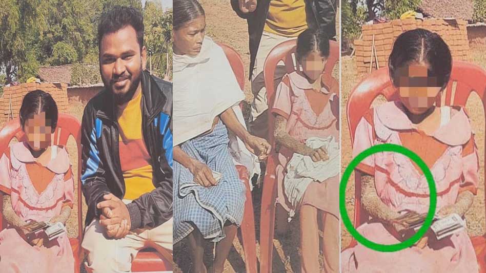 दुर्लभ बीमारी से पीड़ित बच्ची के उपचार के लिए बाल आयोग हरकत में, प्रशासन से मांगी रिपोर्ट